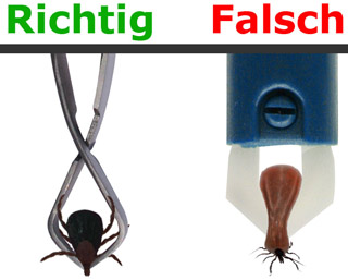Zecke entfernen